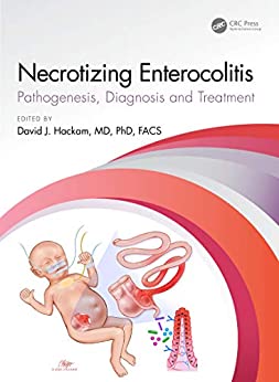 Necrotizing Enterocolitis: pathogenesis, diagnosis and treatment (Original PDF from Publisher) Necrotizing Enterocolitis: pathogenesis, diagnosis and treatment (Original PDF from Publisher)