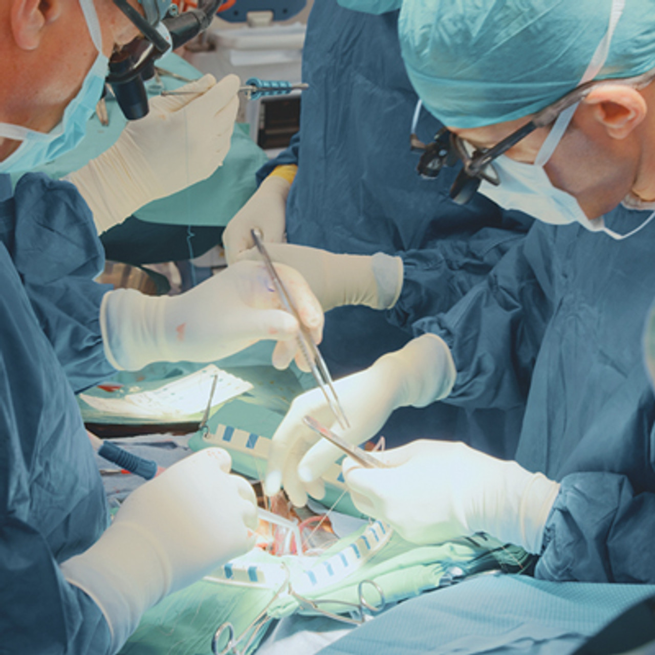 Oakstone Comprehensive Review of Cardiac Surgery 2025 Oakstone Comprehensive Review of Cardiac Surgery 2025