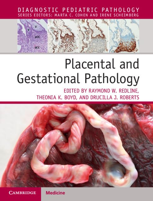 Placental and Gestational Pathology (Diagnostic Pediatric Pathology) (Original PDF from Publisher) Placental and Gestational Pathology (Diagnostic Pediatric Pathology) (Original PDF from Publisher)
