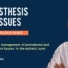 Prosthesis and Tissues (Prosthetic Management of Periodontal and Peri-Implant Tissues)