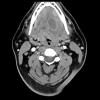 MRIOnline Imaging Mastery Series: Pathology of the Oral Cavity and Oropharynx 2020 (CME VIDEOS) MRIOnline Imaging Mastery Series: Pathology of the Oral Cavity and Oropharynx 2020 (CME VIDEOS)