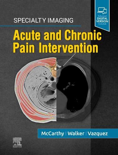 Specialty Imaging: Acute and Chronic Pain Intervention (Original PDF from Publisher) Specialty Imaging: Acute and Chronic Pain Intervention (Original PDF from Publisher)