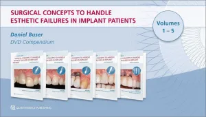 Surgical Concepts to Handle Esthetic Failures in Implant Patients Surgical Concepts to Handle Esthetic Failures in Implant Patients