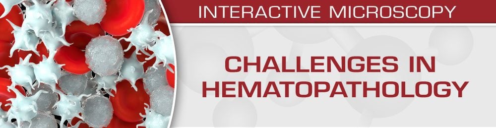 USCAP Challenges in Hematopathology 2019 USCAP Challenges in Hematopathology 2019