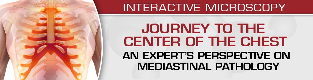 USCAP Journey to the Center of the Chest: An Expert’s Perspective On Mediastinal Pathology 2021 USCAP Journey to the Center of the Chest: An Expert’s Perspective On Mediastinal Pathology 2021