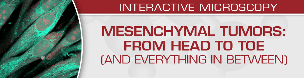 USCAP Mesenchymal Tumors: From Head to Toe (and Everything in Between) 2022 (CME VIDEOS) USCAP Mesenchymal Tumors: From Head to Toe (and Everything in Between) 2022 (CME VIDEOS)