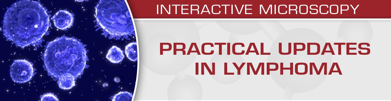 USCAP Practical Updates in Lymphoma 2018 USCAP Practical Updates in Lymphoma 2018