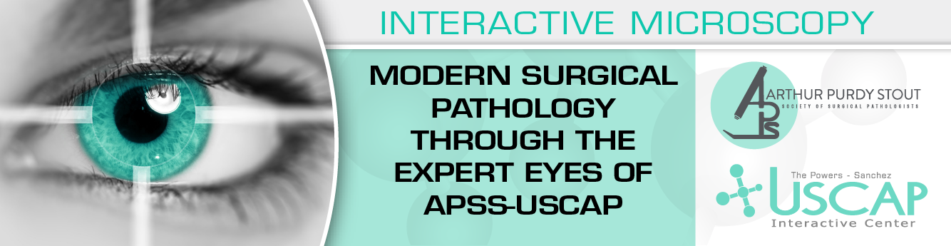 USCAP Second Edition Modern Surgical Pathology Through the Expert Eyes of APSS-USCAP 2020 USCAP Second Edition Modern Surgical Pathology Through the Expert Eyes of APSS-USCAP 2020