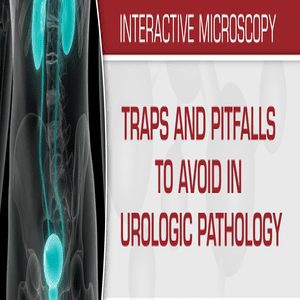 USCAP Traps And Pitfalls To Avoid In Urologic Pathology 2019 (CME VIDEOS) USCAP Traps And Pitfalls To Avoid In Urologic Pathology 2019 (CME VIDEOS)