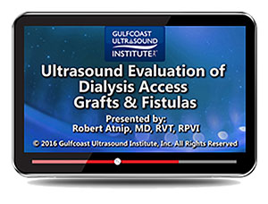 Ultrasound Evaluation of Dialysis Access Grafts and Fistula Ultrasound Evaluation of Dialysis Access Grafts and Fistula