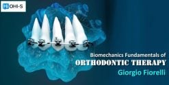 OHI-S Biomechanics Fundamentals of Orthodontic Therapy – Giorgio Fiorelli