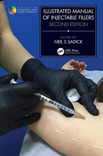 Illustrated Manual of Injectable Fillers (Series in Cosmetic and Laser Therapy), 2nd Edition (Original PDF from Publisher) Illustrated Manual of Injectable Fillers (Series in Cosmetic and Laser Therapy), 2nd Edition (Original PDF from Publisher)
