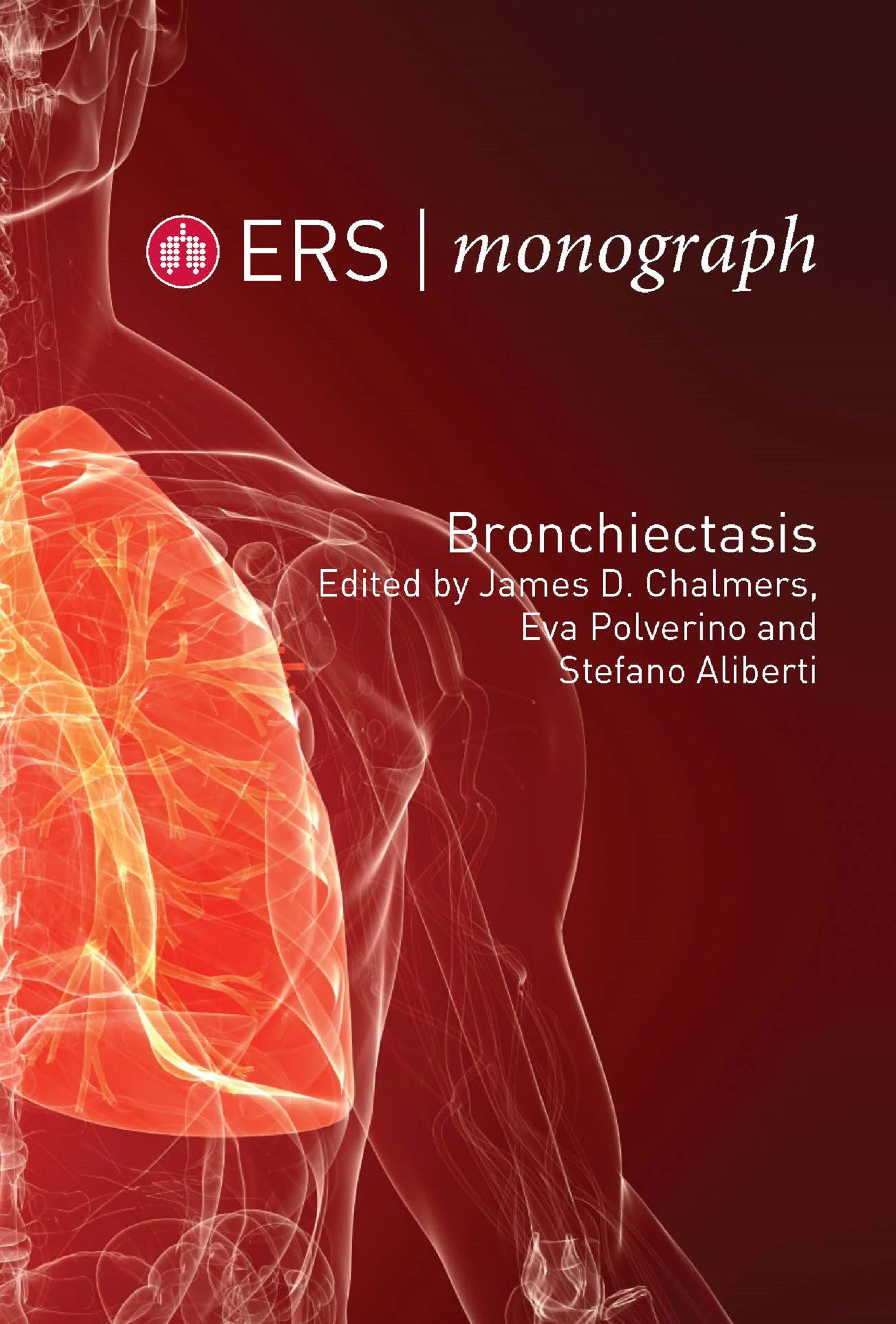 ERS Monograph: Bronchiectasis (Original PDF from Publisher) ERS Monograph: Bronchiectasis (Original PDF from Publisher)