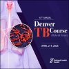 National Jewish Health 61st Annual Denver TB Course 2025 National Jewish Health 61st Annual Denver TB Course 2025