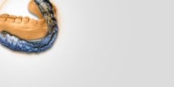 OHI-S OCTA concept Occlusal architecture to secure orthodontic or prosthodontic adults treatments