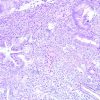 Oakstone Gynecologic Pathology 2026