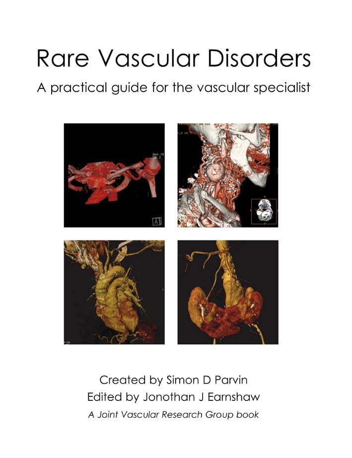 Rare Vascular Disorders: A practical guide for the vascular specialist (Original PDF from Publisher) Rare Vascular Disorders A practical guide for the vascular specialist (Original PDF from Publisher)