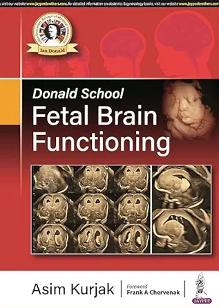 Donald School Fetal Brain Functioning (EPUB and pdf) Donald School Fetal Brain Functioning (EPUB and pdf)