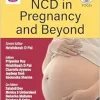 NCD in Pregnancy and Beyond (Original PDF from Publisher) NCD in Pregnancy and Beyond (Original PDF from Publisher)