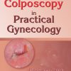 Colposcopy in Practical Gynecology (EPUB and pdf) Colposcopy in Practical Gynecology (EPUB and pdf)