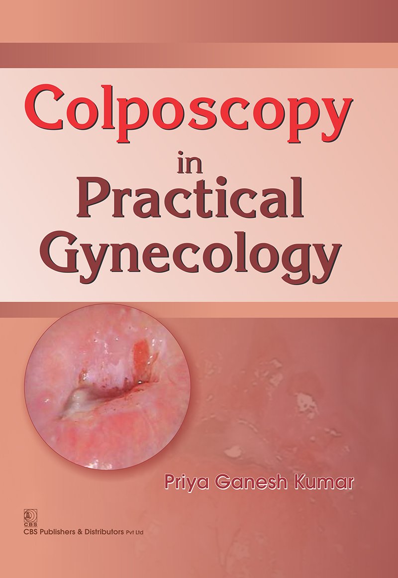 Colposcopy in Practical Gynecology (EPUB and pdf) Colposcopy in Practical Gynecology (EPUB and pdf)