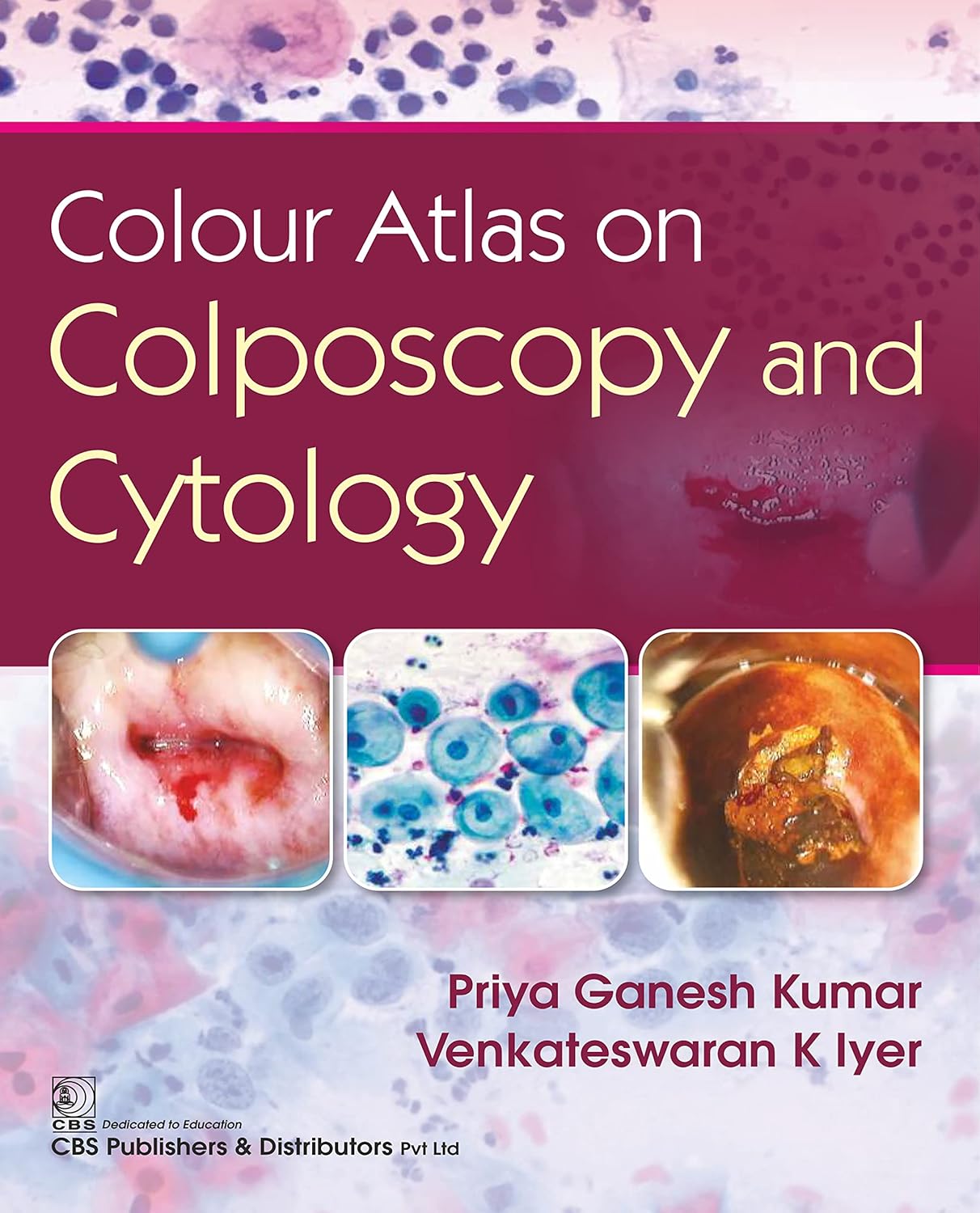 Colour Atlas on Colposcpoy and Cytology (Original PDF from Publisher) Colour Atlas on Colposcpoy and Cytology (Original PDF from Publisher)