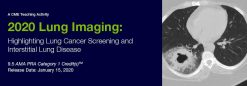 ARRS Lung Cancer Screening A Comprehensive Guide Online Course