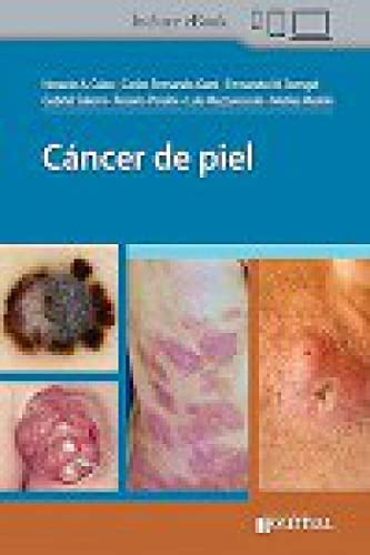 Cáncer de piel (Original PDF from Publisher) Cáncer de piel (Original PDF from Publisher)