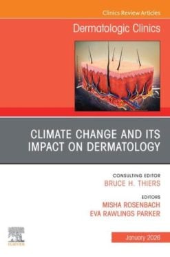Climate Change and its Impact on Dermatology, An Issue of Dermatologic Clinics (Original PDF from Publisher)