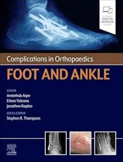 Complications in Orthopaedics: Foot and Ankle (EPUB)