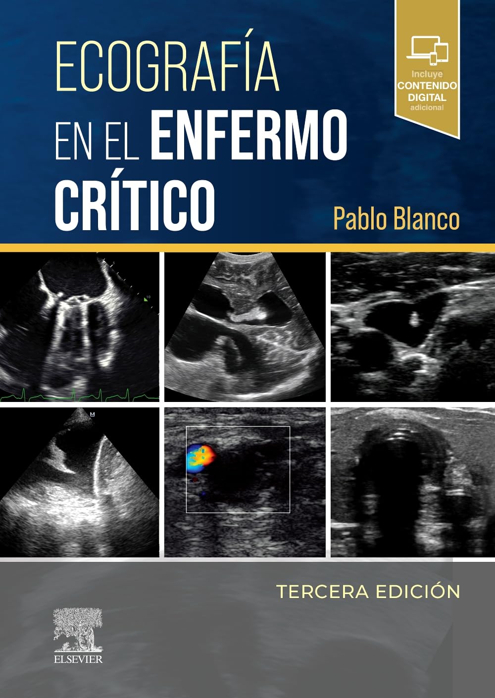 Ecografía en el enfermo crítico, 3rd Edition (Original PDF from Publisher) Ecografía en el enfermo crítico, 3rd Edition (Original PDF from Publisher)