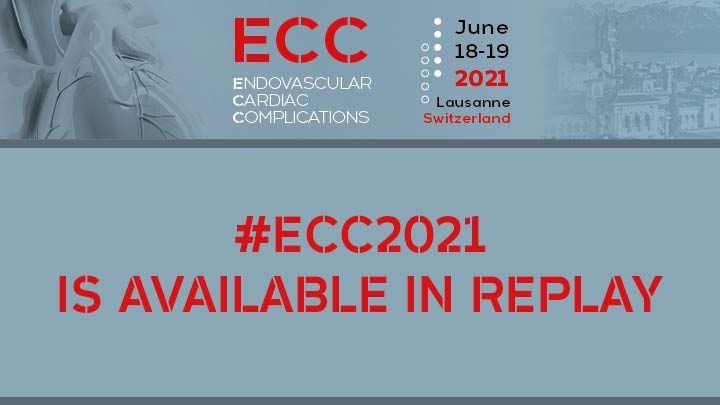 Endovascular Cardiac Complications 2021 Endovascular Cardiac Complications 2021