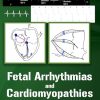 Fetal Arrhythmias and Cardiomyopathies – simplified (AZW3 + EPUB + Converted PDF) Fetal Arrhythmias and Cardiomyopathies – simplified (AZW3 + EPUB + Converted PDF)