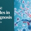 Harvard Molecular Diagnostics Current Roles in Cancer Diagnosis 2026 Harvard Molecular Diagnostics Current Roles in Cancer Diagnosis 2026