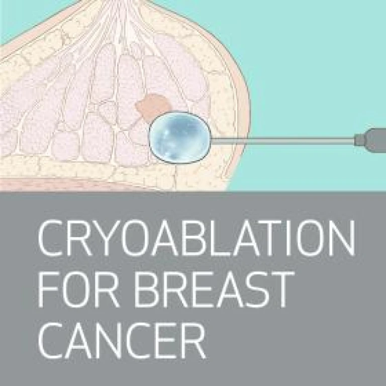 Houston Methodist Advanced Interventional Breast Imaging: Cryoablation, CEM, MRI, Stereotactic and Ultrasound Guidance 2025 Houston Methodist Advanced Interventional Breast Imaging