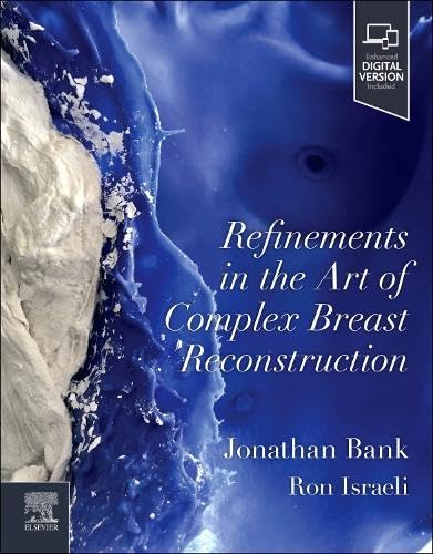 Refinements in the Art of Complex Breast Reconstruction (Original PDF from Publisher) Refinements in the Art of Complex Breast Reconstruction (Original PDF from Publisher)