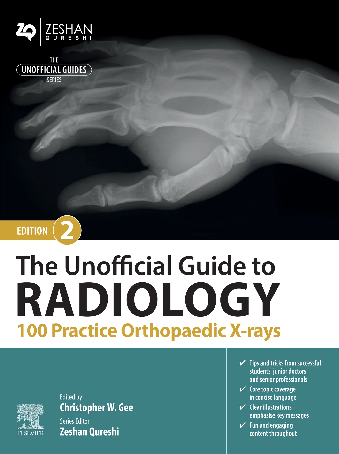 The Unofficial Guide to Radiology: 100 Practice Orthopaedic X-rays, 2nd Edition (EPUB) The Unofficial Guide to Radiology: 100 Practice Orthopaedic X-rays, 2nd Edition (EPUB)