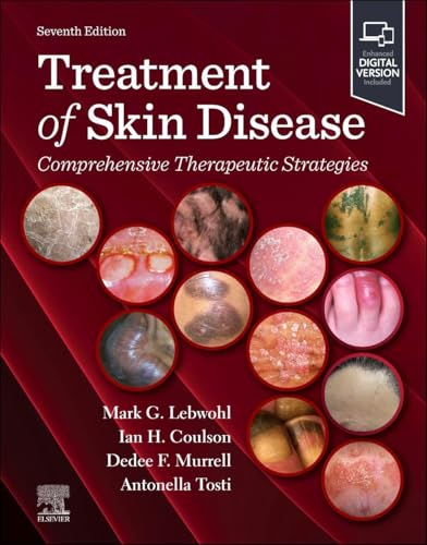 Treatment of Skin Disease: Comprehensive Therapeutic Strategies, 7th edition (EPUB) Treatment of Skin Disease: Comprehensive Therapeutic Strategies, 7th edition (EPUB)
