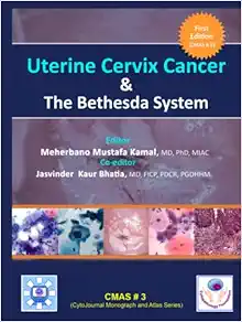 Uterine Cervix Cancer The Bethesda System: CMAS # 3 (CytoJournal Monograph / Atlas Series) (Original PDF from Publisher) Uterine Cervix Cancer The Bethesda System CMAS # 3 (CytoJournal Monograph Atlas Series) (Original PDF from Publisher)