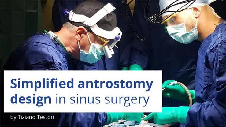 Osteocom - Simplified Antrostomy Design in Sinus Surgery - Tiziano Testori Osteocom - Simplified Antrostomy Design in Sinus Surgery - Tiziano Testori