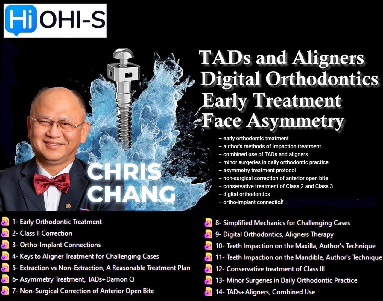 OHI-S TADs and Aligners, Digital Orthodontics, Early Treatment, Face Asymmetry OHI-S TADs and Aligners, Digital Orthodontics, Early Treatment, Face Asymmetry