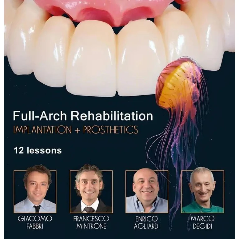 OHI-S Full-Arch Rehabilitation, Implantation and Prosthetics OHI-S Full-Arch Rehabilitation, Implantation and Prosthetics