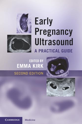 Early Pregnancy Ultrasound, 2nd edition (EPUB) Early Pregnancy Ultrasound, 2nd edition (EPUB)
