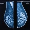 Oakstone UCSF Breast Imaging 2026