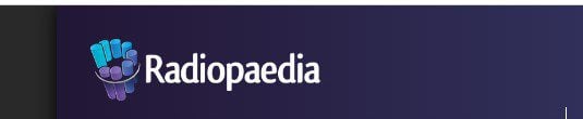 Radiopaedia ADULT BRAIN MRI REVIEW COURSE Radiopaedia ADULT BRAIN MRI REVIEW COURSE