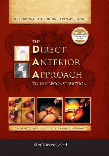 The Direct Anterior Approach to Hip Reconstruction (PDF) The Direct Anterior Approach to Hip Reconstruction (PDF)