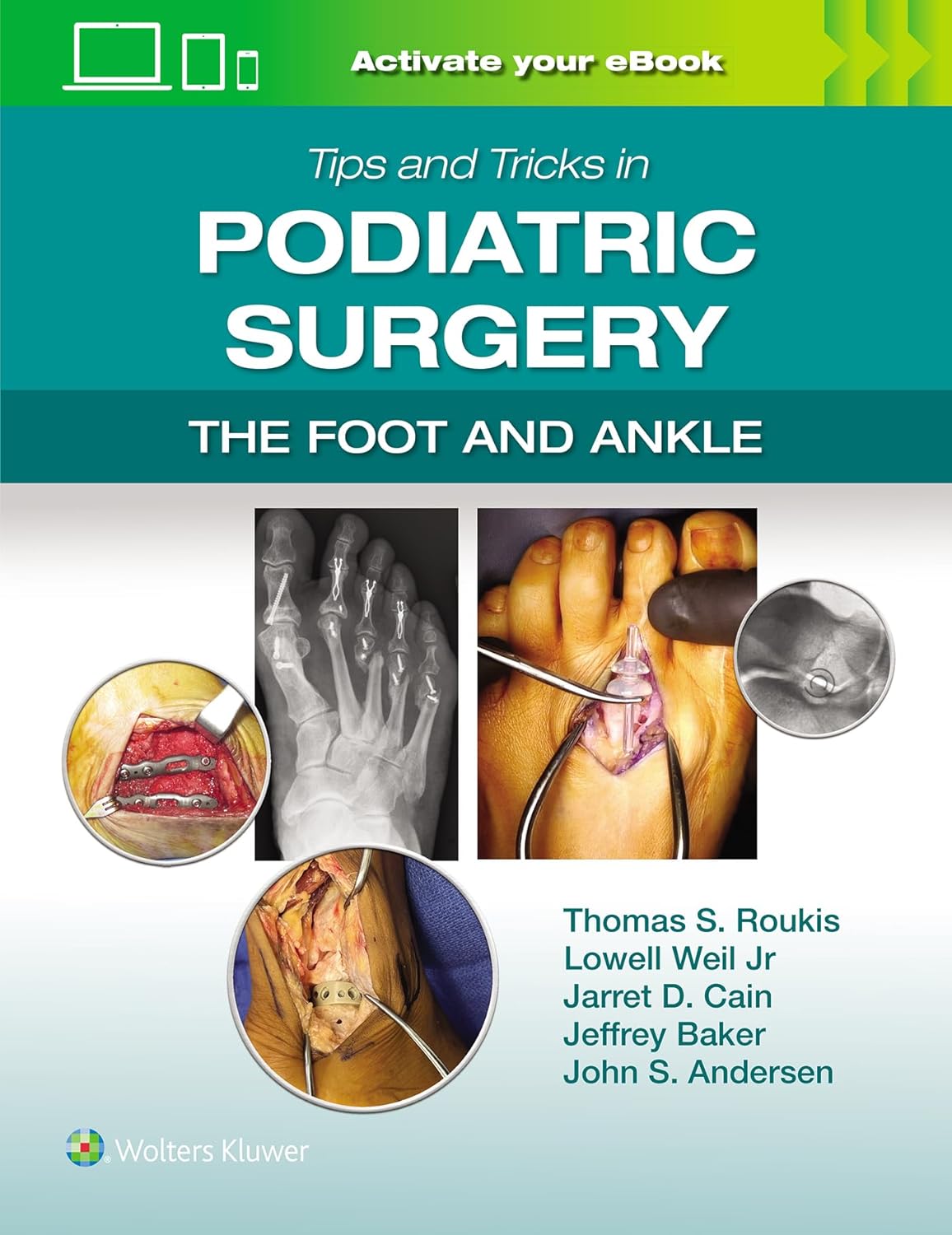 Tips and Tricks in Podiatric Surgery: The Foot and Ankle (Videos only) Tips and Tricks in Podiatric Surgery