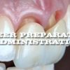 Mastery Academy Veneer Preparation and Administration – Anas Aloum Mastery Academy Veneer Preparation and Administration – Anas Aloum