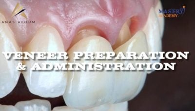 Mastery Academy Veneer Preparation and Administration – Anas Aloum Mastery Academy Veneer Preparation and Administration – Anas Aloum