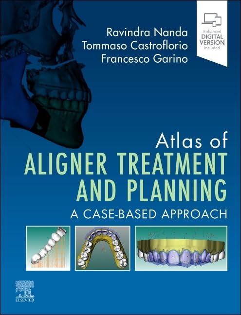 Atlas of Aligner Treatment and Planning: A Case-Based Approach (Original PDF from Publisher) Atlas of Aligner Treatment and Planning: A Case-Based Approach (Original PDF from Publisher)